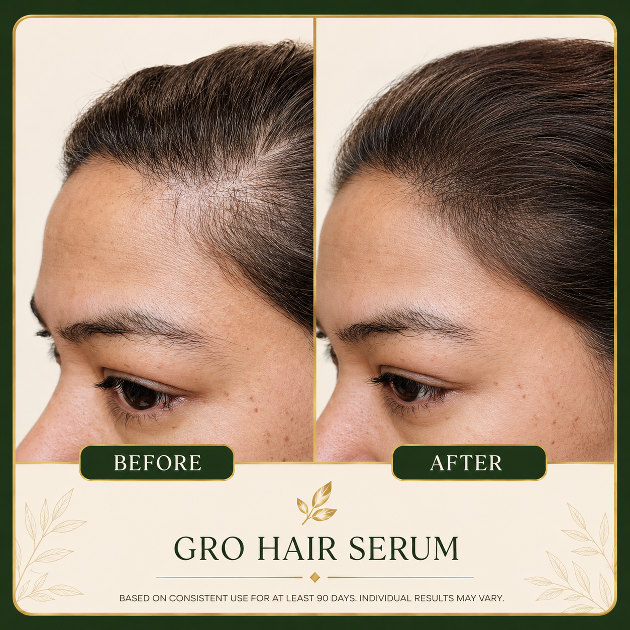 ALIVARA Botanical Hair Growth Serum