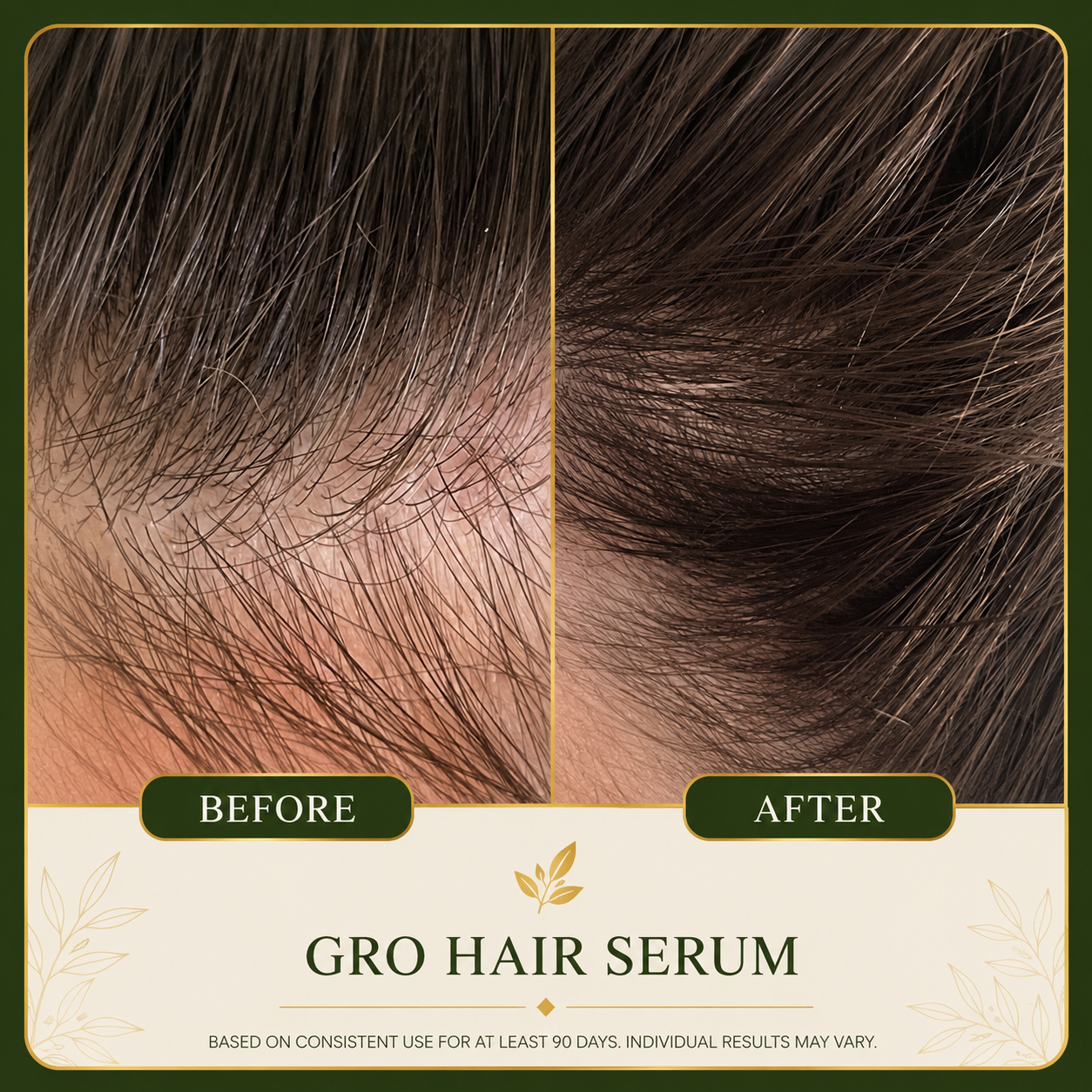 ALIVARA Botanical Hair Growth Serum